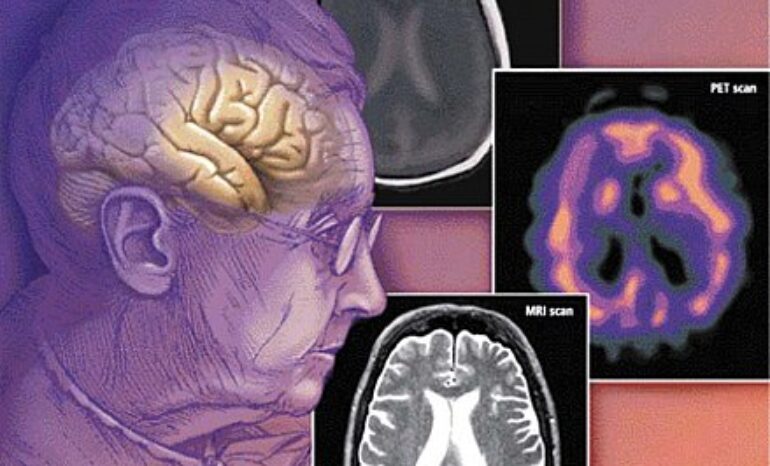الشيخوخة.. بداياتها مؤلمة بدنياً ونفسياً !(من موقع جريدة الرياض -...